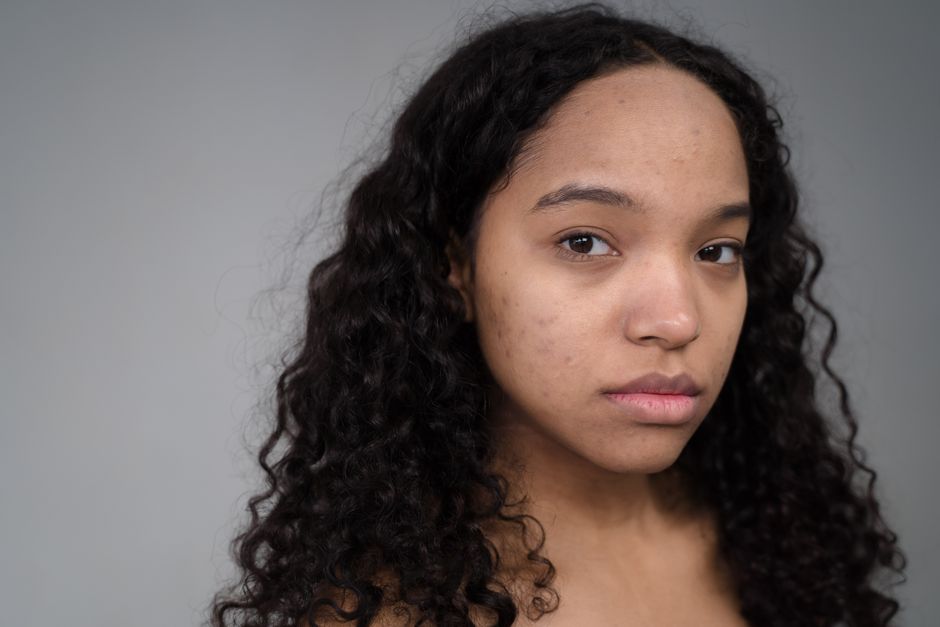 Close-up portrait of a young woman with curly hair and natural skin texture, looking confidently at the camera.