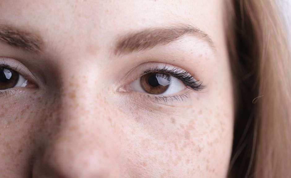 A detailed close-up of a woman's eye and freckles highlighting natural beauty.