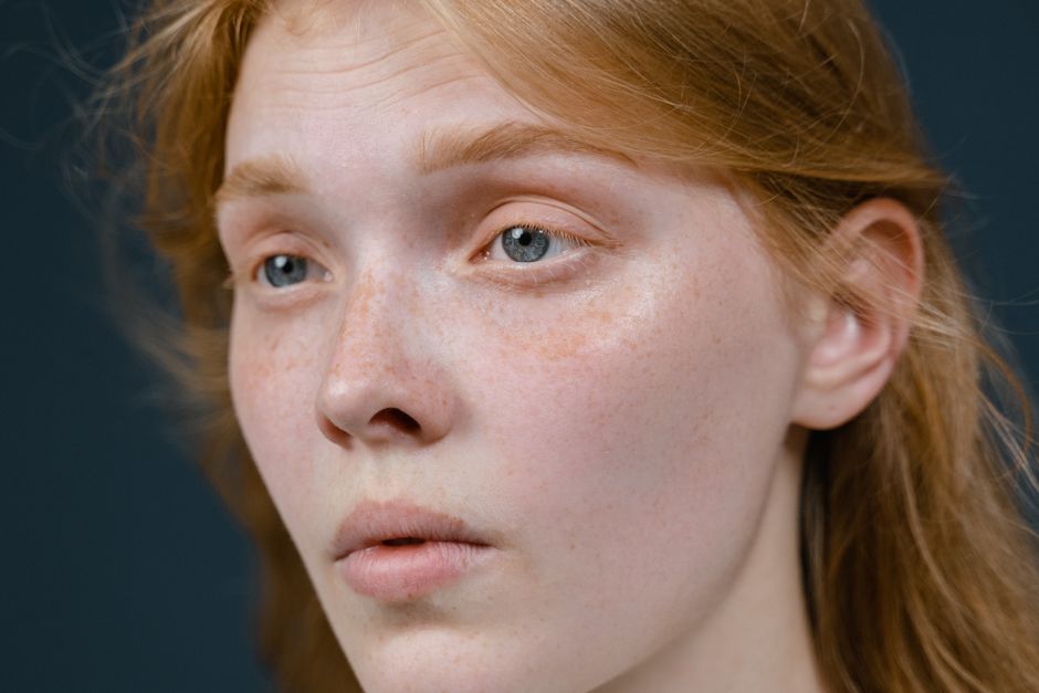 Close-up of a young woman's face displaying natural freckles and thoughtful expression.