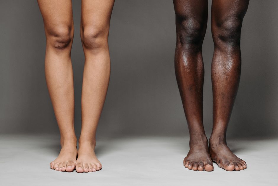 Image of two pairs of diverse bare legs standing against a gray background, showcasing skin tone variety.